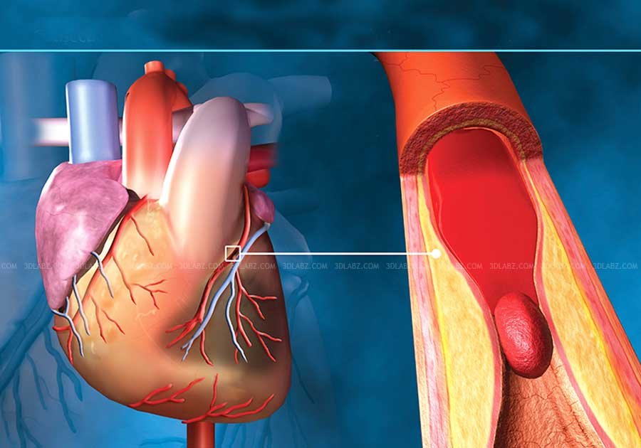 Medical 3D Illustrations