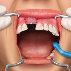 2D and 3D medical illustration services in India for healthcare and pharma