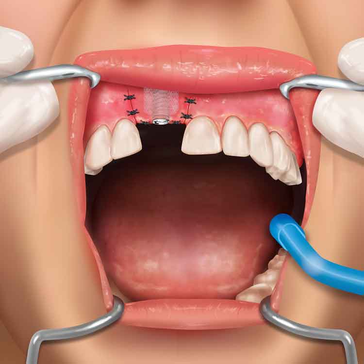 2D and 3D medical illustration services in India for healthcare and pharma