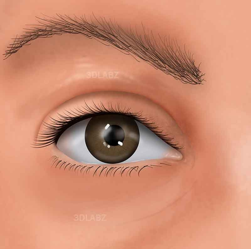 Dental Immediate Implant Surgery 2D Illustration