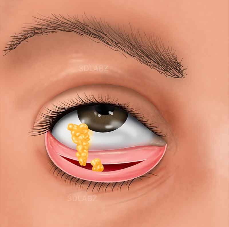 2D illustration showing dental surgery