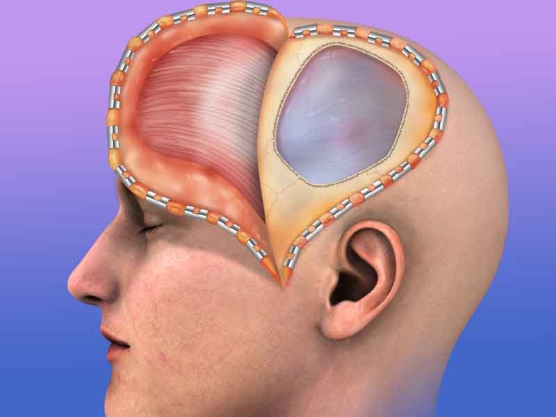 A 3D still render from cranioplasty surgery patient teaching video