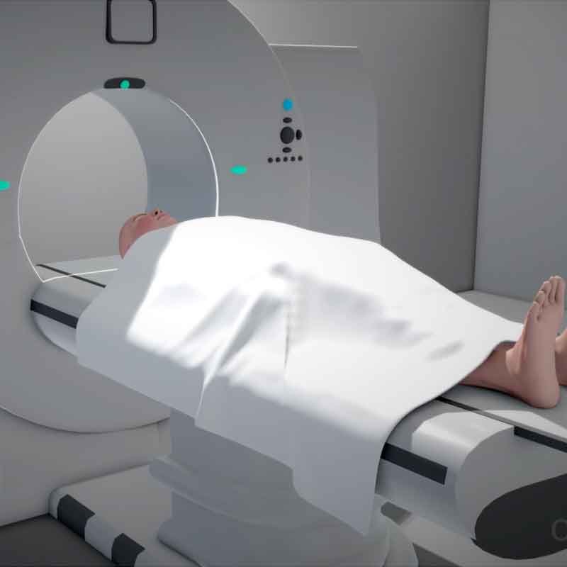 3D image from cranioplasty surgery animation