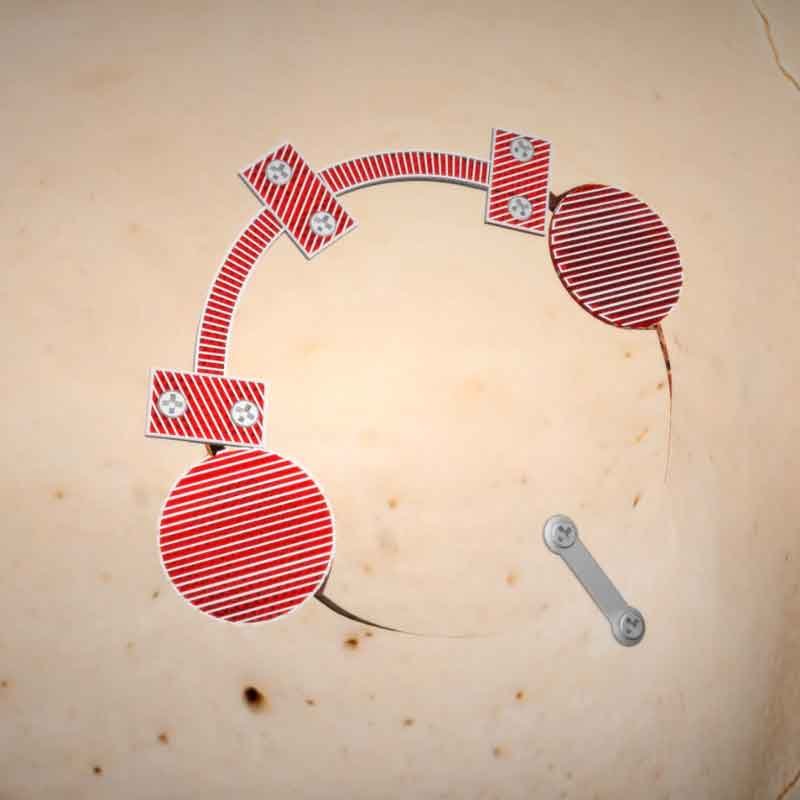 3D render image from craniotomy brain surgery 3D animation