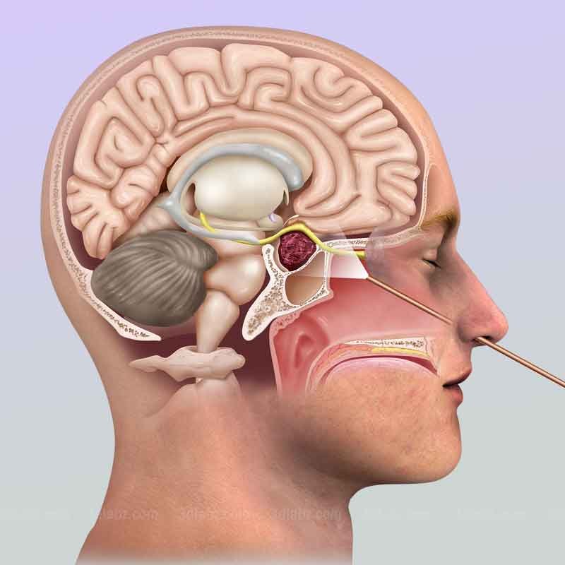 A medical art of endoscopic endonasal surgery