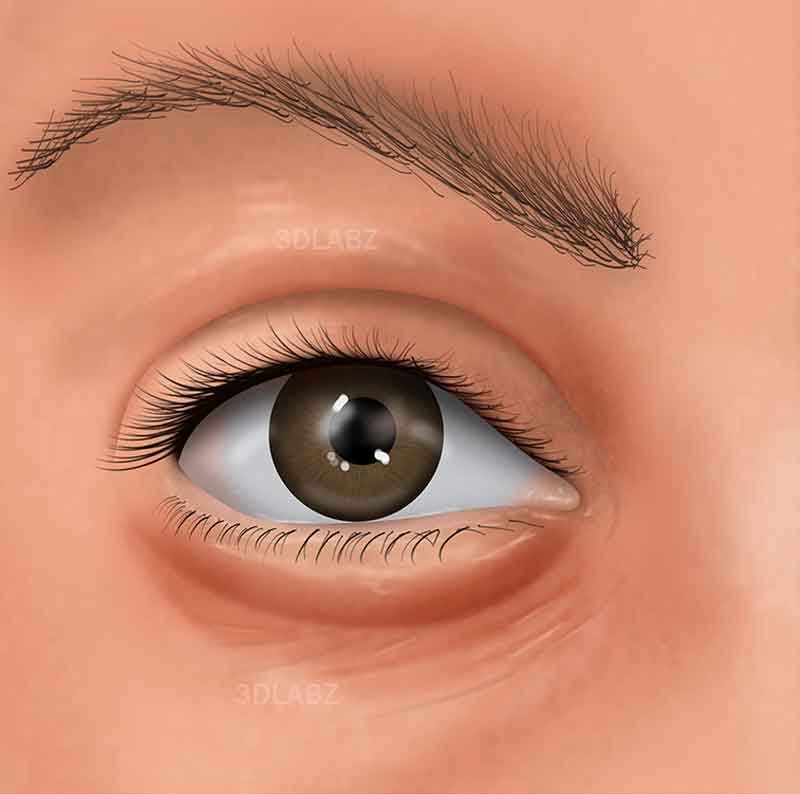 Illustration showing dental implant surgical procedure