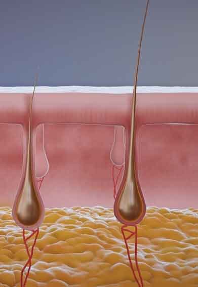 3D still render from patient education video showing hair loss and restoration