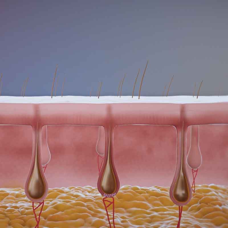 3d medical rendering from hair restoration animation london