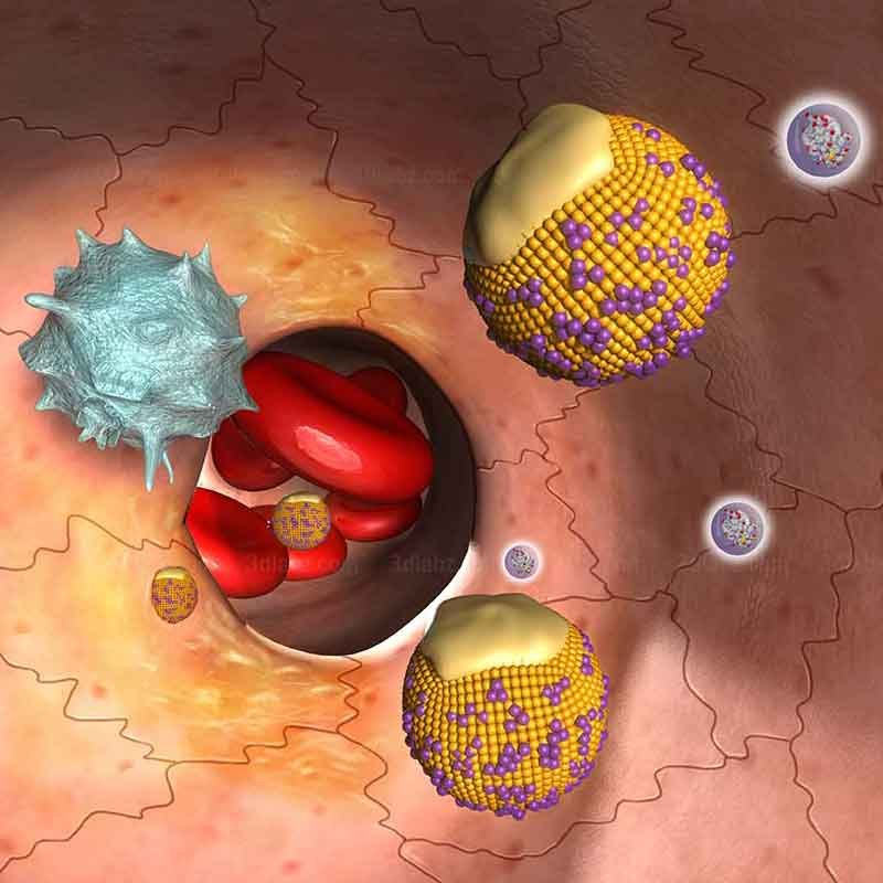 A 3D render image showing high cholesterol