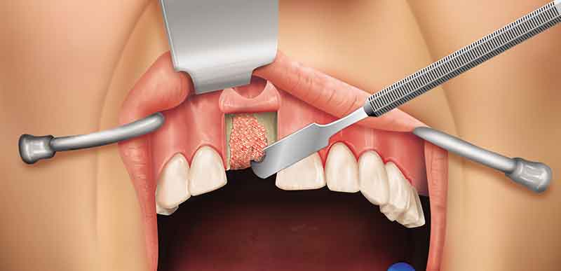 Medical illustration showing dental surgery
