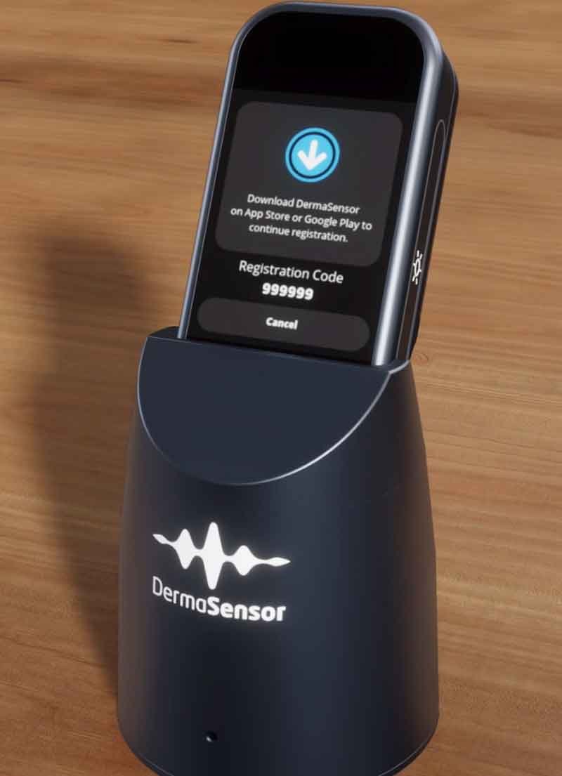 3D still render of a skin cancer detection medical device