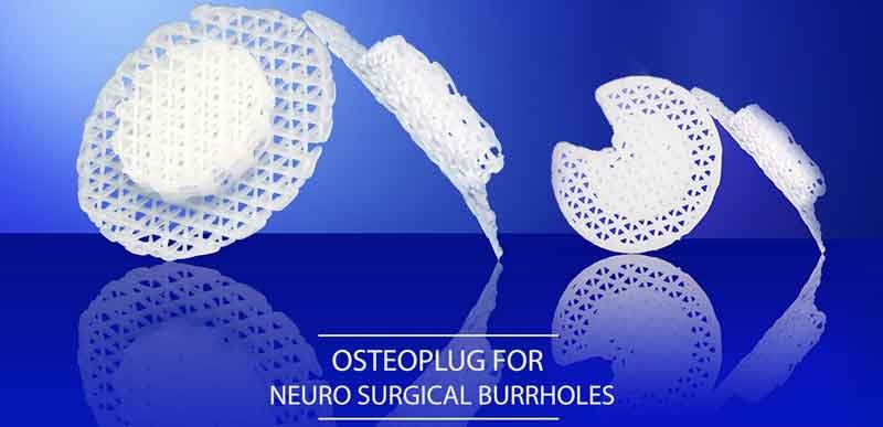 Osteoplug 3D Illustration for Neuro surgery