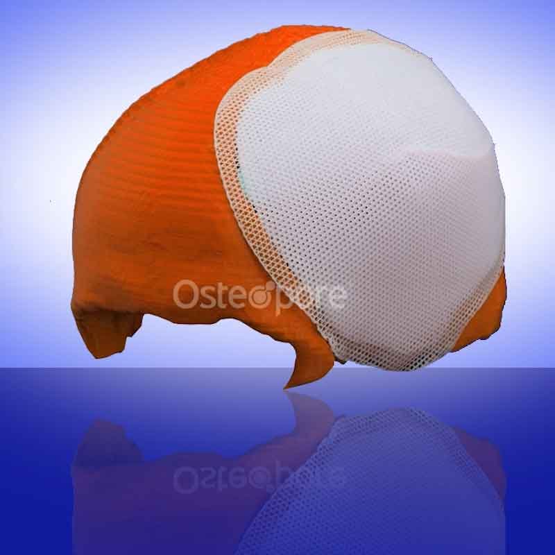 Image of a medical product from medical company promotional video